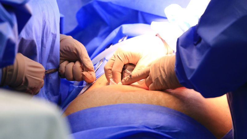 Câmara aprova projeto que obriga divulgação de lista de espera do SUS