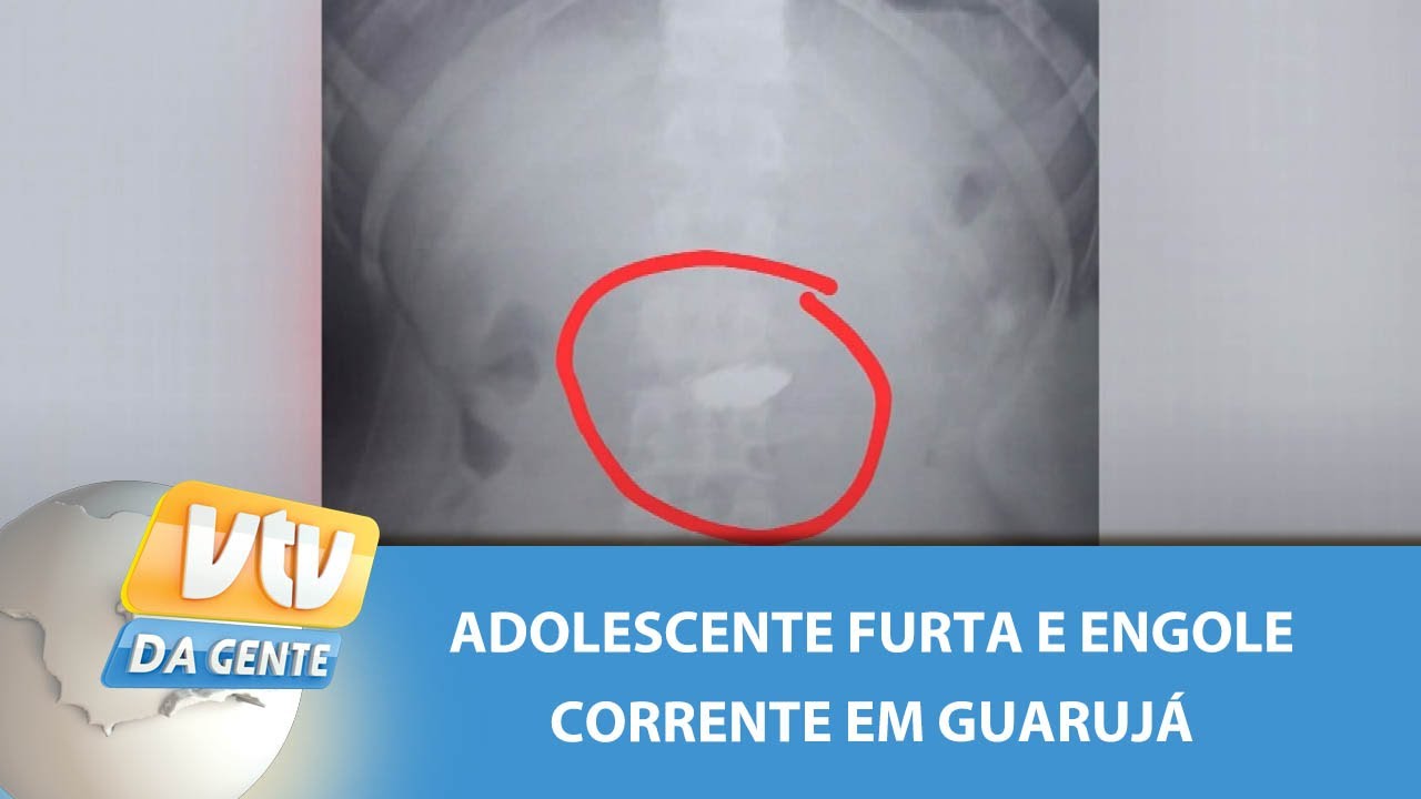 Adolescente furta e engole corrente em Guarujá | VTV da Gente