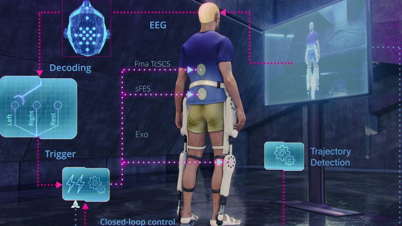 Hospital italiano usa tecnologia de Nicolelis em pacientes – 05/03/2024 – Tec