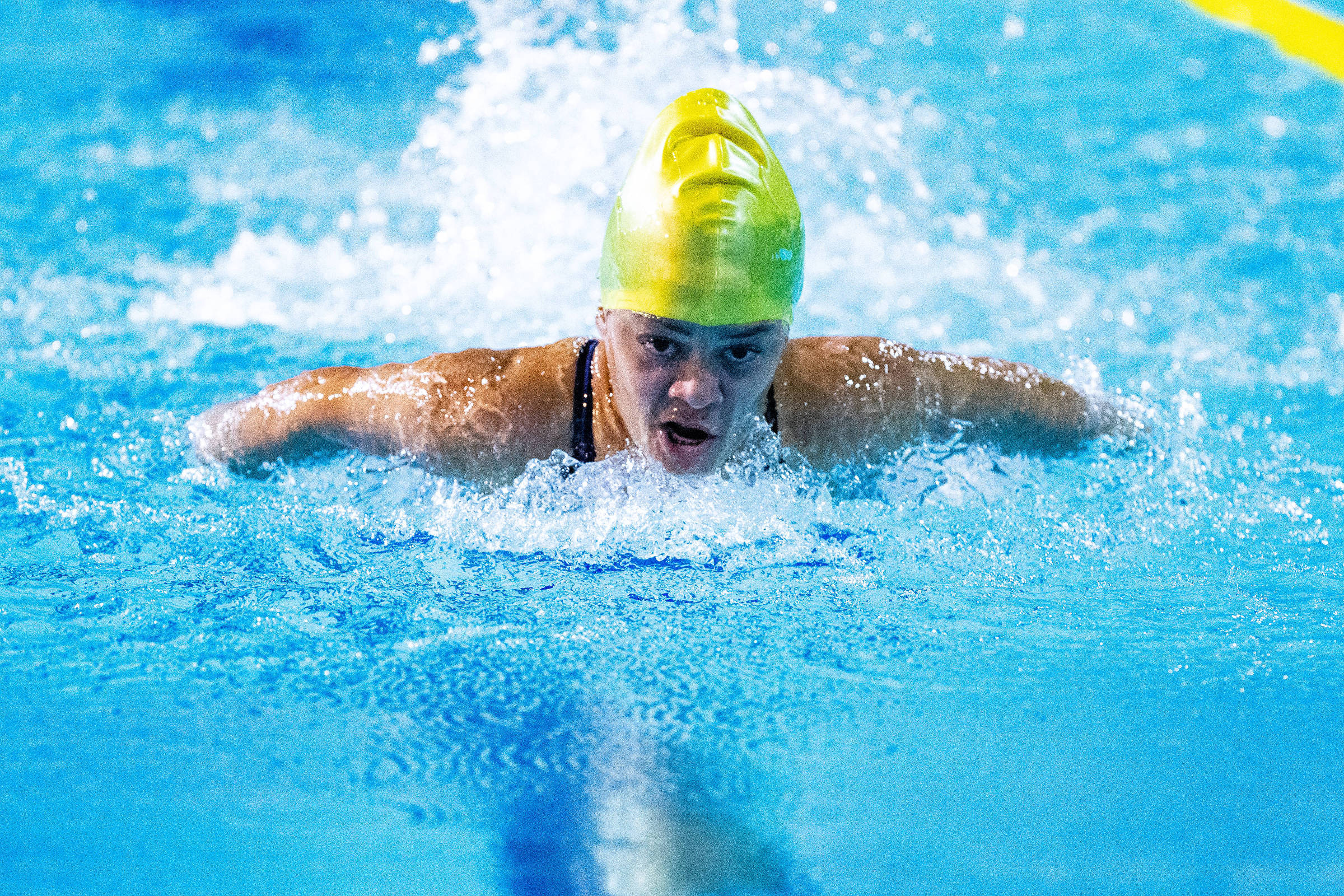 Medalhista paralímpica Joana Neves morre aos 37 anos em São Paulo – 18/03/2024 – Esporte