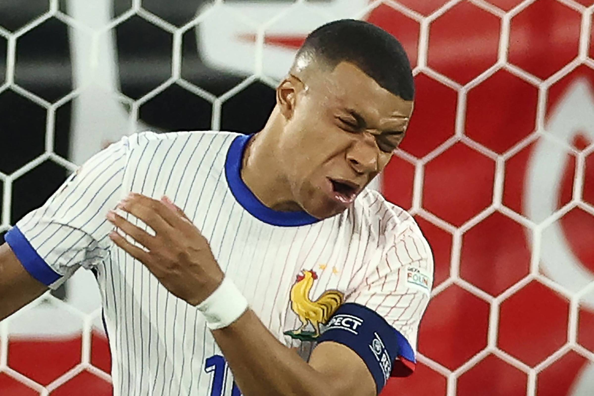 Mbappé escapa de cirurgia, mas pede ‘ideias para máscaras’ – 19/06/2024 – Esporte