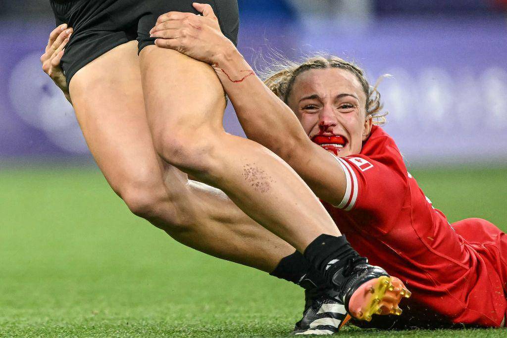 As 20 fotos mais espetaculares da Olimpíada de Paris – 07/08/2024 – Esporte