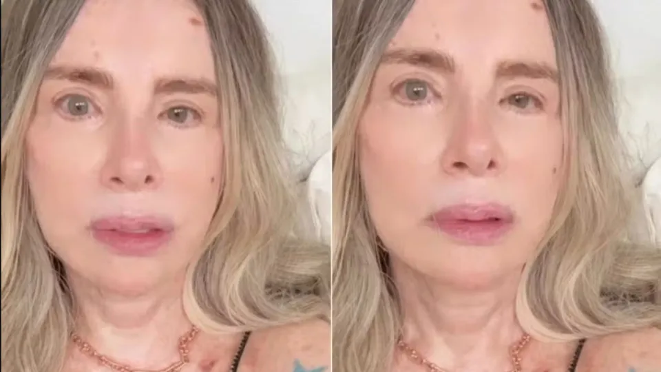 Isis de Oliveira faz nova cirurgia e revela: ‘Luma não me liga’