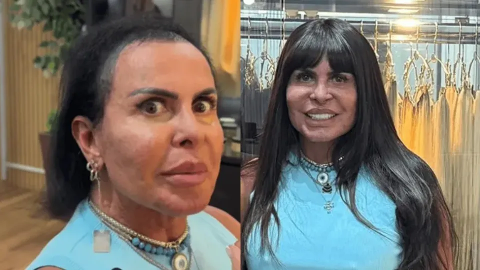 Gretchen mostra calvície e põe novo cabelo para o Power Couple